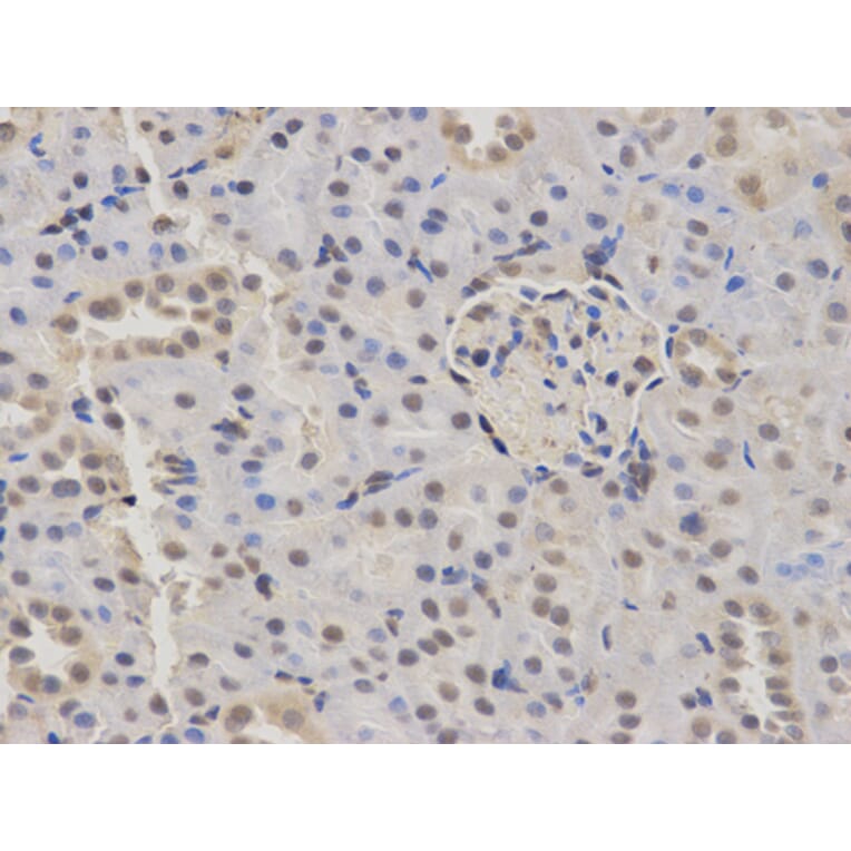 Anti-KDM1A Antibody from Bioworld Technology (BS6189) - Antibodies.com