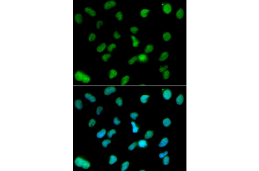 Anti-KDM1A Antibody from Bioworld Technology (BS6189) - Antibodies.com