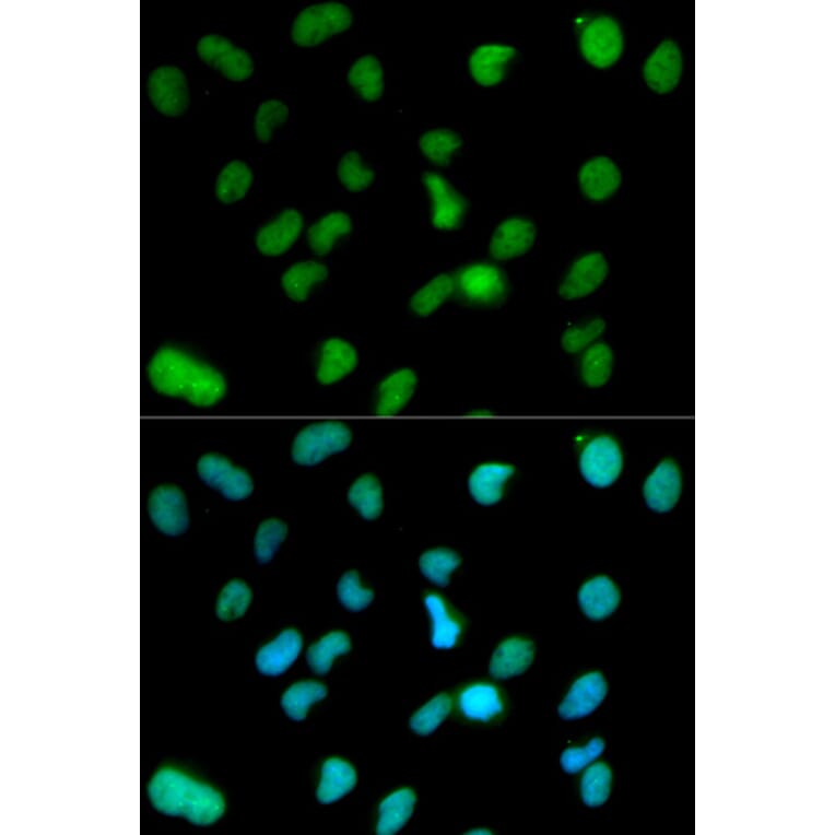 Anti-KDM1A Antibody from Bioworld Technology (BS6189) - Antibodies.com
