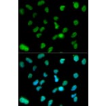 Anti-KDM1A Antibody from Bioworld Technology (BS6189) - Antibodies.com