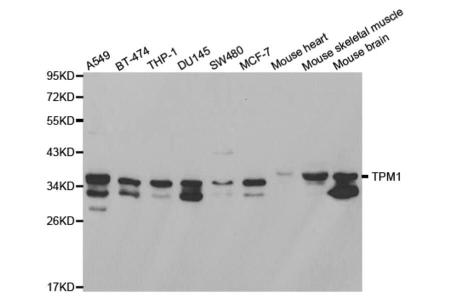 Anti-Tropomyosin α Antibody from Bioworld Technology (BS6190) - Antibodies.com
