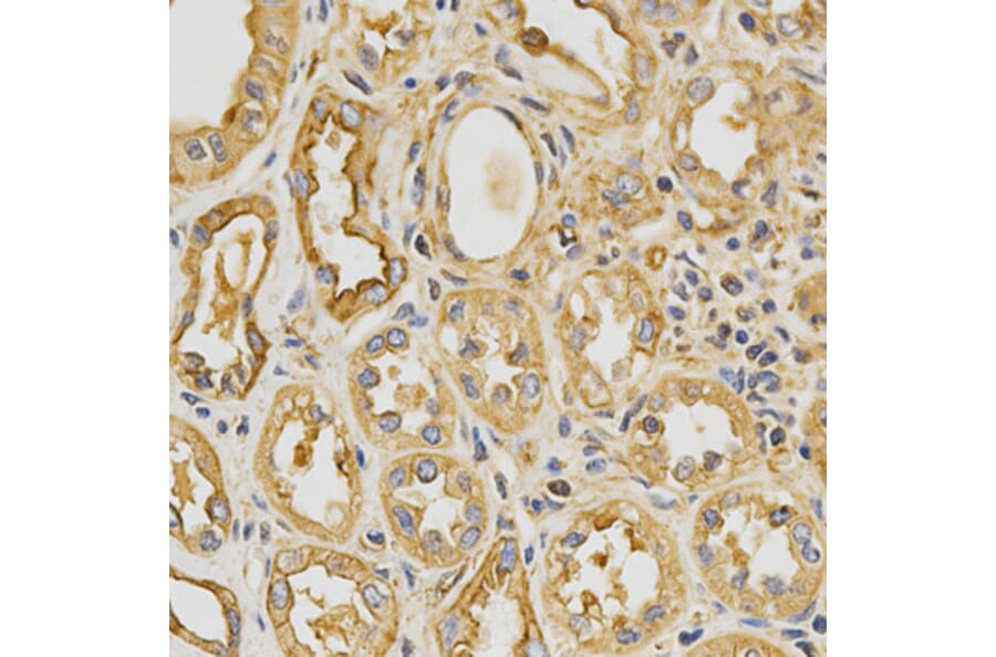Anti-Tropomyosin α Antibody from Bioworld Technology (BS6190) - Antibodies.com