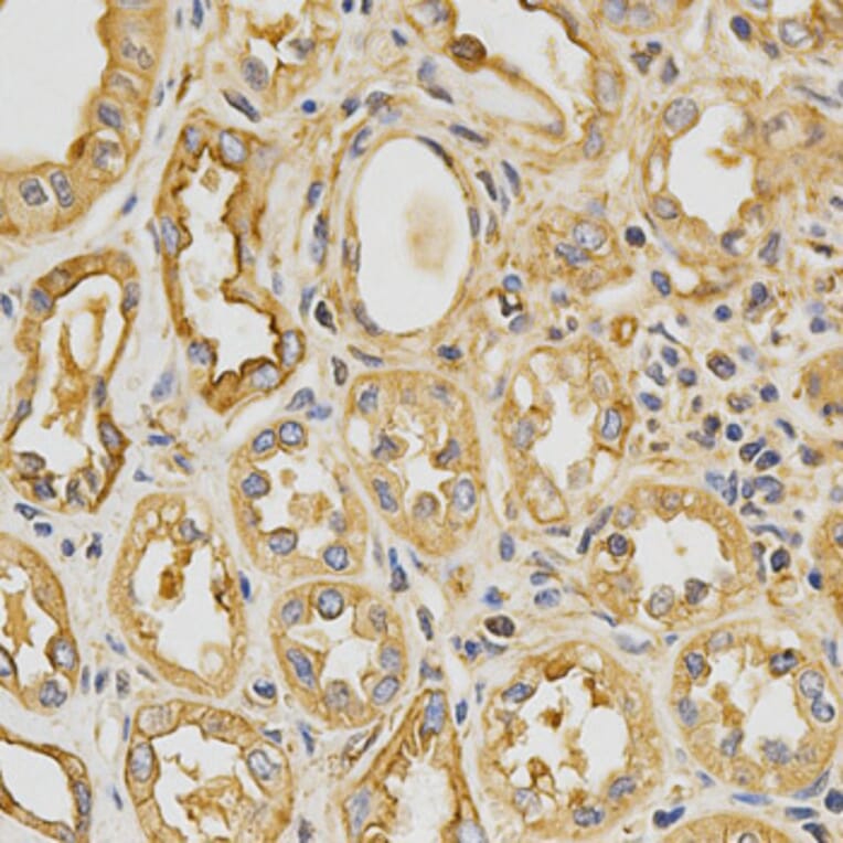 Anti-Tropomyosin α Antibody from Bioworld Technology (BS6190) - Antibodies.com