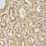 Anti-Tropomyosin α Antibody from Bioworld Technology (BS6190) - Antibodies.com