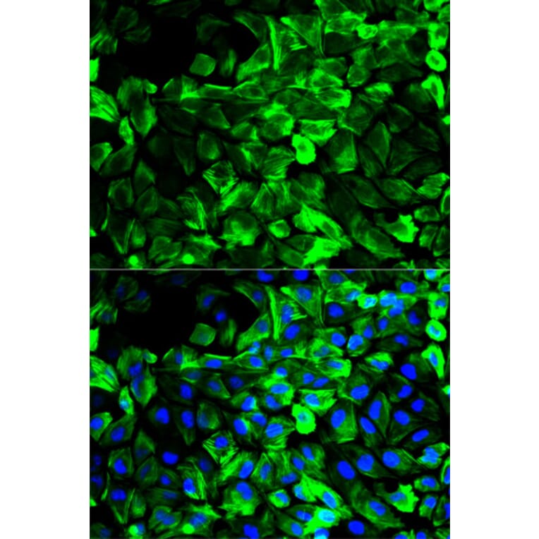 Anti-Tropomyosin α Antibody from Bioworld Technology (BS6190) - Antibodies.com