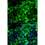 Anti-Tropomyosin α Antibody from Bioworld Technology (BS6190) - Antibodies.com