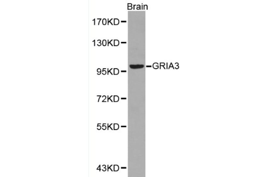 Anti-GRIA3 Antibody from Bioworld Technology (BS6193) - Antibodies.com
