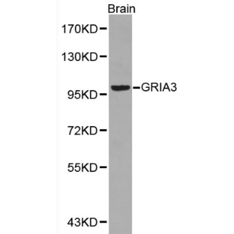 Anti-GRIA3 Antibody from Bioworld Technology (BS6193) - Antibodies.com