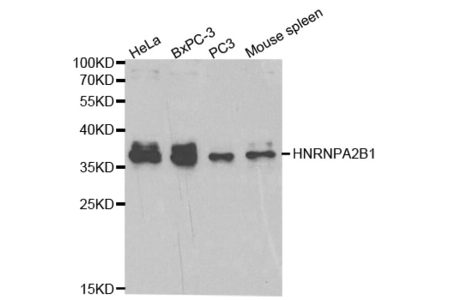 Anti-HNRNPA2B1 Antibody from Bioworld Technology (BS6196) - Antibodies.com
