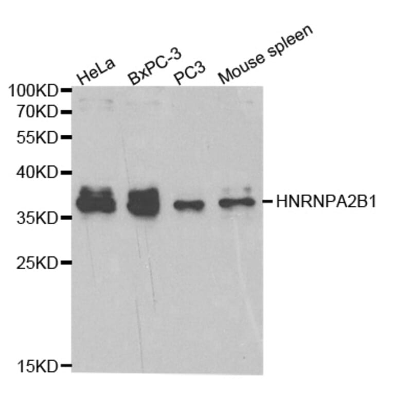 Anti-HNRNPA2B1 Antibody from Bioworld Technology (BS6196) - Antibodies.com