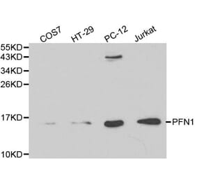 Anti-PFN1 Antibody from Bioworld Technology (BS6198) - Antibodies.com