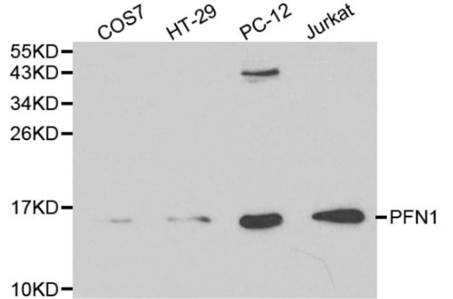 Anti-PFN1 Antibody from Bioworld Technology (BS6198) - Antibodies.com