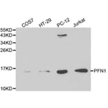 Anti-PFN1 Antibody from Bioworld Technology (BS6198) - Antibodies.com