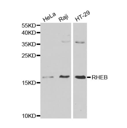 Anti-RHEB Antibody from Bioworld Technology (BS6199) - Antibodies.com