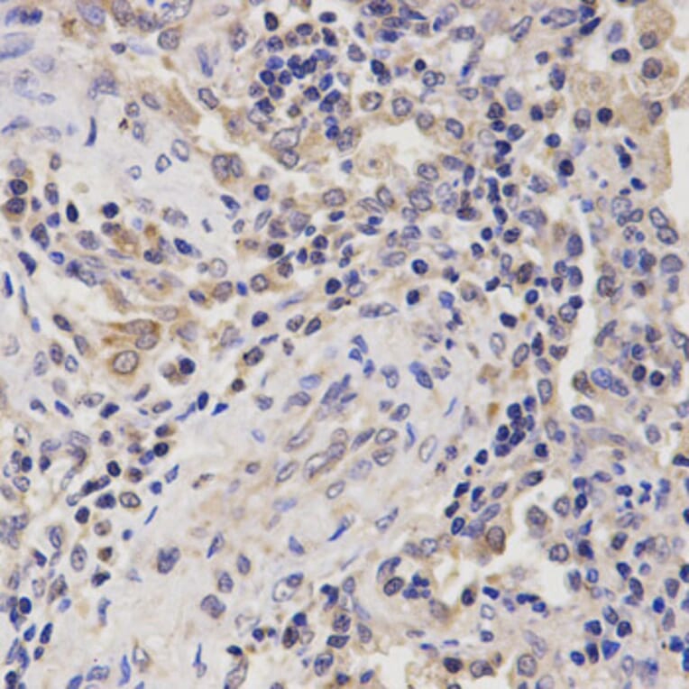 Anti-RHEB Antibody from Bioworld Technology (BS6199) - Antibodies.com