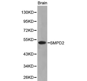 Anti-SMPD2 Antibody from Bioworld Technology (BS6200) - Antibodies.com