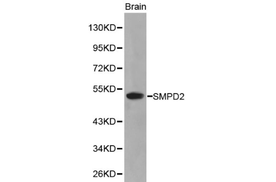 Anti-SMPD2 Antibody from Bioworld Technology (BS6200) - Antibodies.com