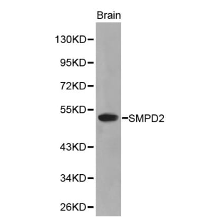 Anti-SMPD2 Antibody from Bioworld Technology (BS6200) - Antibodies.com