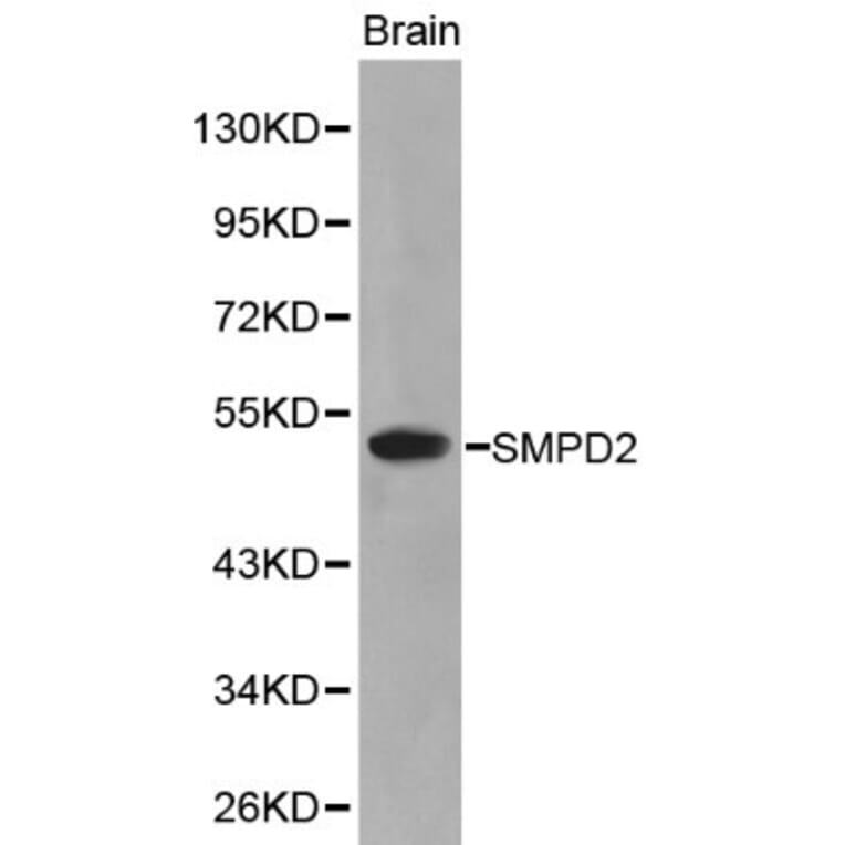 Anti-SMPD2 Antibody from Bioworld Technology (BS6200) - Antibodies.com