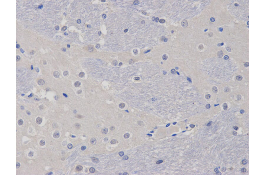 Anti-TCL1A Antibody from Bioworld Technology (BS6201) - Antibodies.com