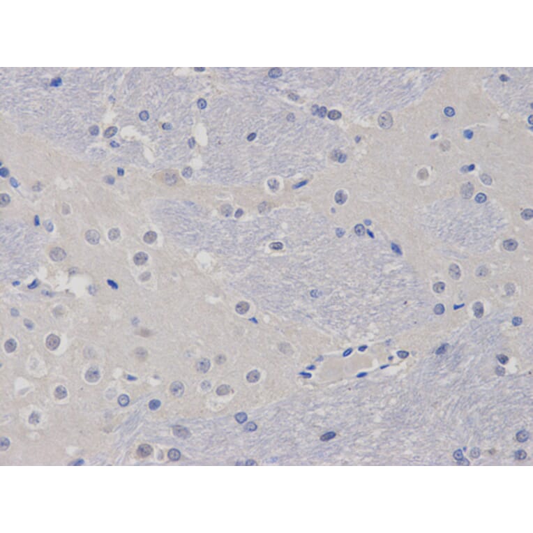 Anti-TCL1A Antibody from Bioworld Technology (BS6201) - Antibodies.com