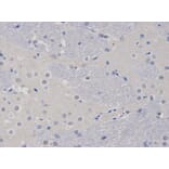 Anti-TCL1A Antibody from Bioworld Technology (BS6201) - Antibodies.com