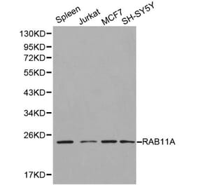 Anti-RAB11A Antibody from Bioworld Technology (BS6202) - Antibodies.com