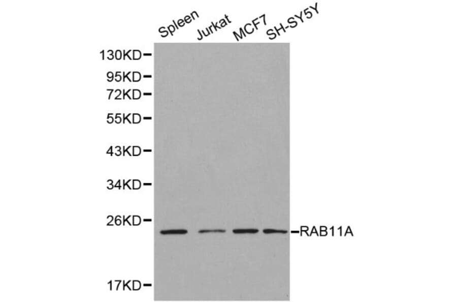 Anti-RAB11A Antibody from Bioworld Technology (BS6202) - Antibodies.com