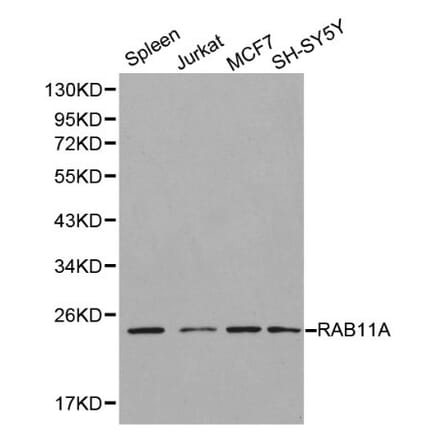 Anti-RAB11A Antibody from Bioworld Technology (BS6202) - Antibodies.com