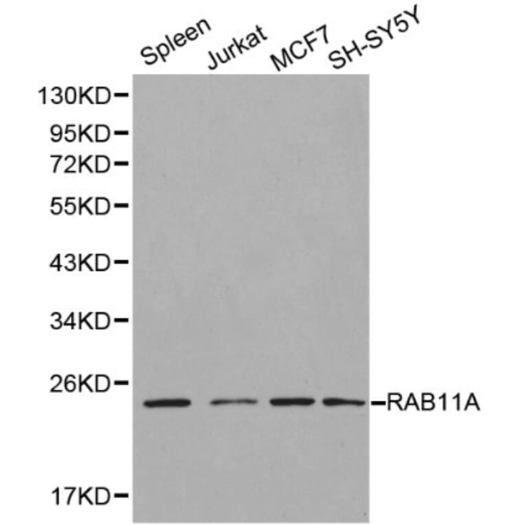 Anti-RAB11A Antibody from Bioworld Technology (BS6202) - Antibodies.com