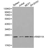 Anti-RAB11A Antibody from Bioworld Technology (BS6202) - Antibodies.com