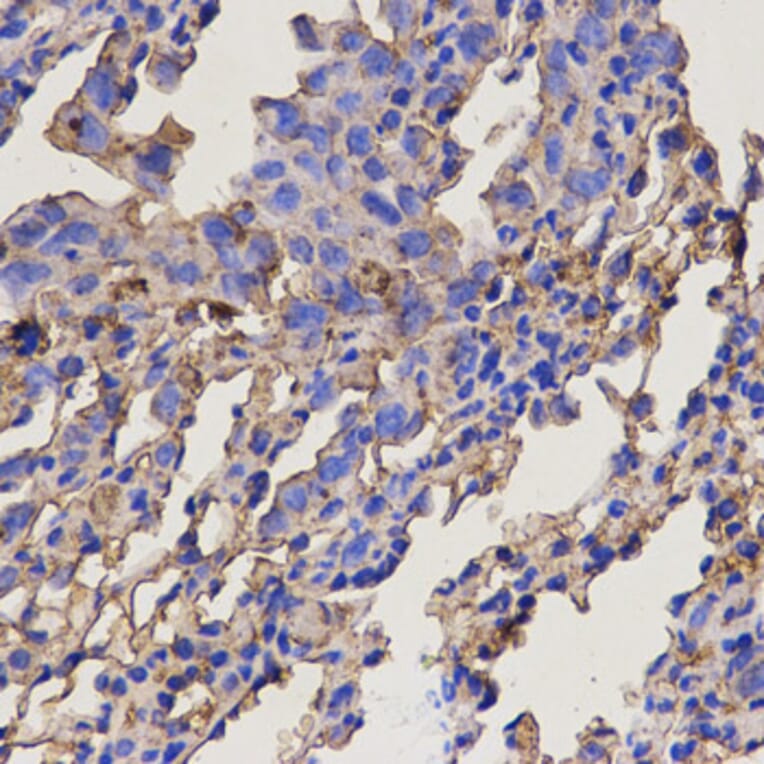 Anti-RAB11A Antibody from Bioworld Technology (BS6202) - Antibodies.com