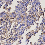 Anti-RAB11A Antibody from Bioworld Technology (BS6202) - Antibodies.com