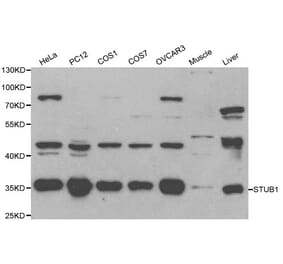 Anti-STUB1 Antibody from Bioworld Technology (BS6204) - Antibodies.com