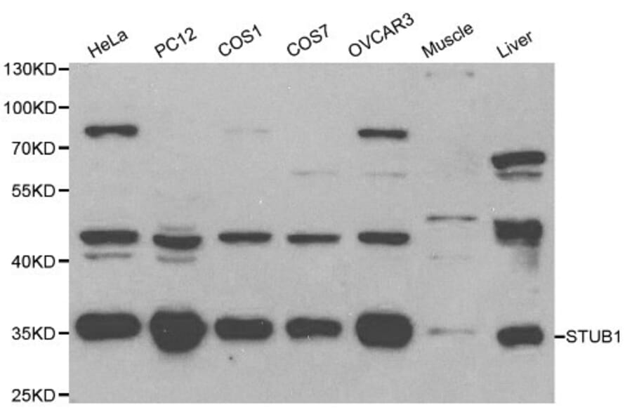 Anti-STUB1 Antibody from Bioworld Technology (BS6204) - Antibodies.com