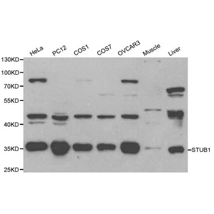 Anti-STUB1 Antibody from Bioworld Technology (BS6204) - Antibodies.com