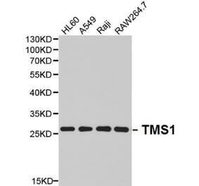 Anti-TMS1 Antibody from Bioworld Technology (BS6205) - Antibodies.com