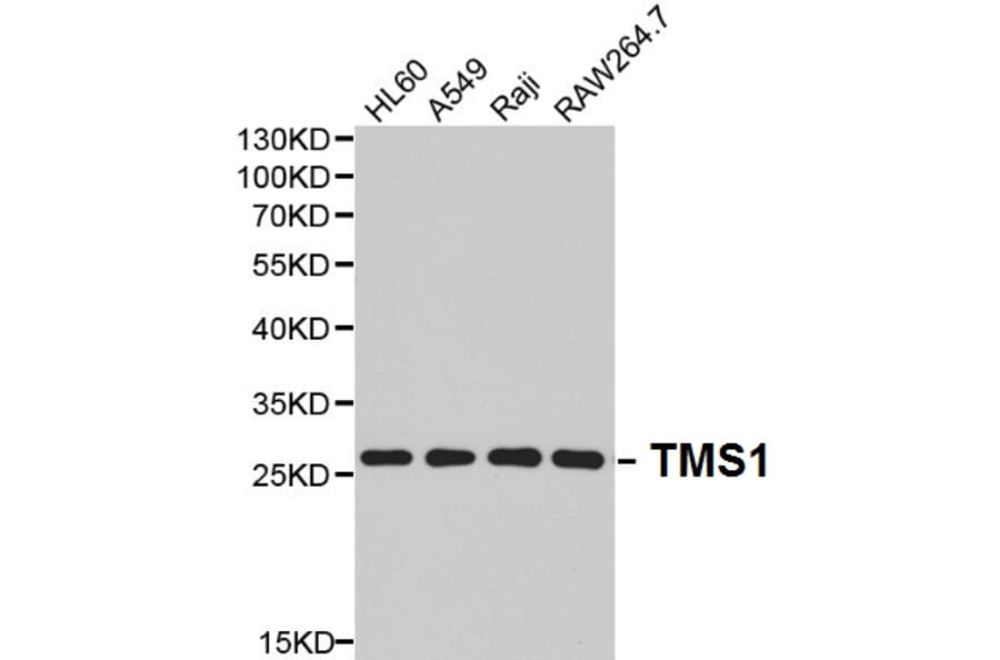 Anti-TMS1 Antibody from Bioworld Technology (BS6205) - Antibodies.com