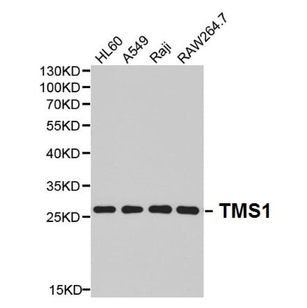 Anti-TMS1 Antibody from Bioworld Technology (BS6205) - Antibodies.com