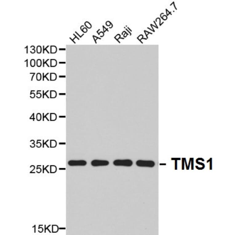 Anti-TMS1 Antibody from Bioworld Technology (BS6205) - Antibodies.com