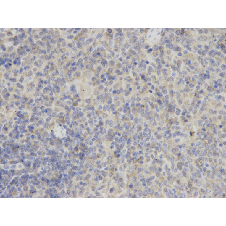 Anti-TMS1 Antibody from Bioworld Technology (BS6205) - Antibodies.com