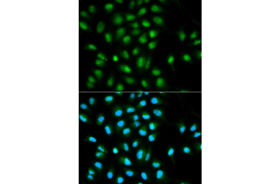 Anti-TMS1 Antibody from Bioworld Technology (BS6205) - Antibodies.com