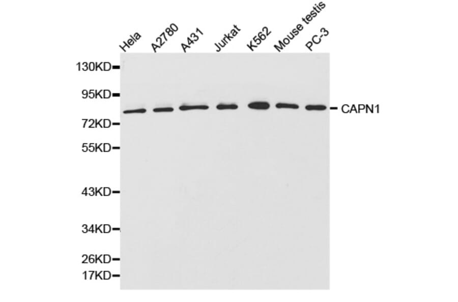 Anti-CAPN1 Antibody from Bioworld Technology (BS6207) - Antibodies.com