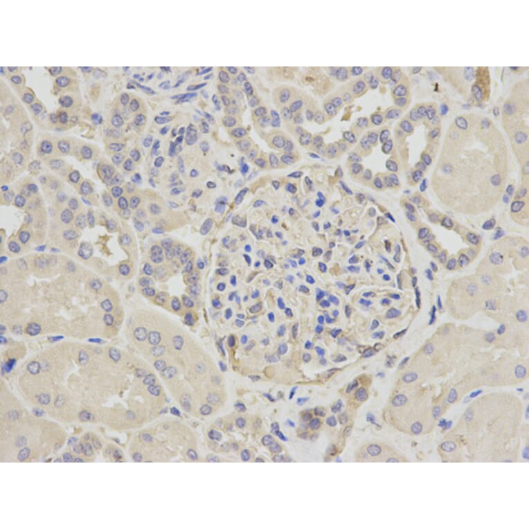 Anti-CAPN1 Antibody from Bioworld Technology (BS6207) - Antibodies.com
