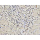 Anti-CAPN1 Antibody from Bioworld Technology (BS6207) - Antibodies.com