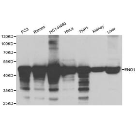 Anti-ENO1 Antibody from Bioworld Technology (BS6209) - Antibodies.com