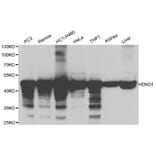 Anti-ENO1 Antibody from Bioworld Technology (BS6209) - Antibodies.com