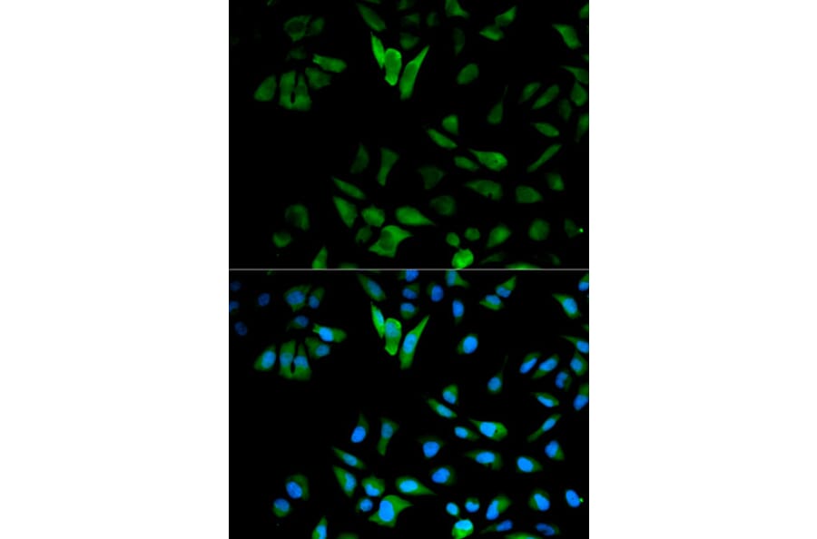 Anti-ENO1 Antibody from Bioworld Technology (BS6209) - Antibodies.com