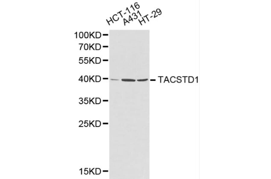Anti-EPCAM Antibody from Bioworld Technology (BS6213) - Antibodies.com
