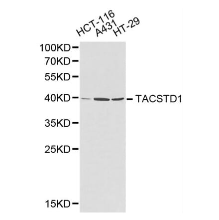 Anti-EPCAM Antibody from Bioworld Technology (BS6213) - Antibodies.com
